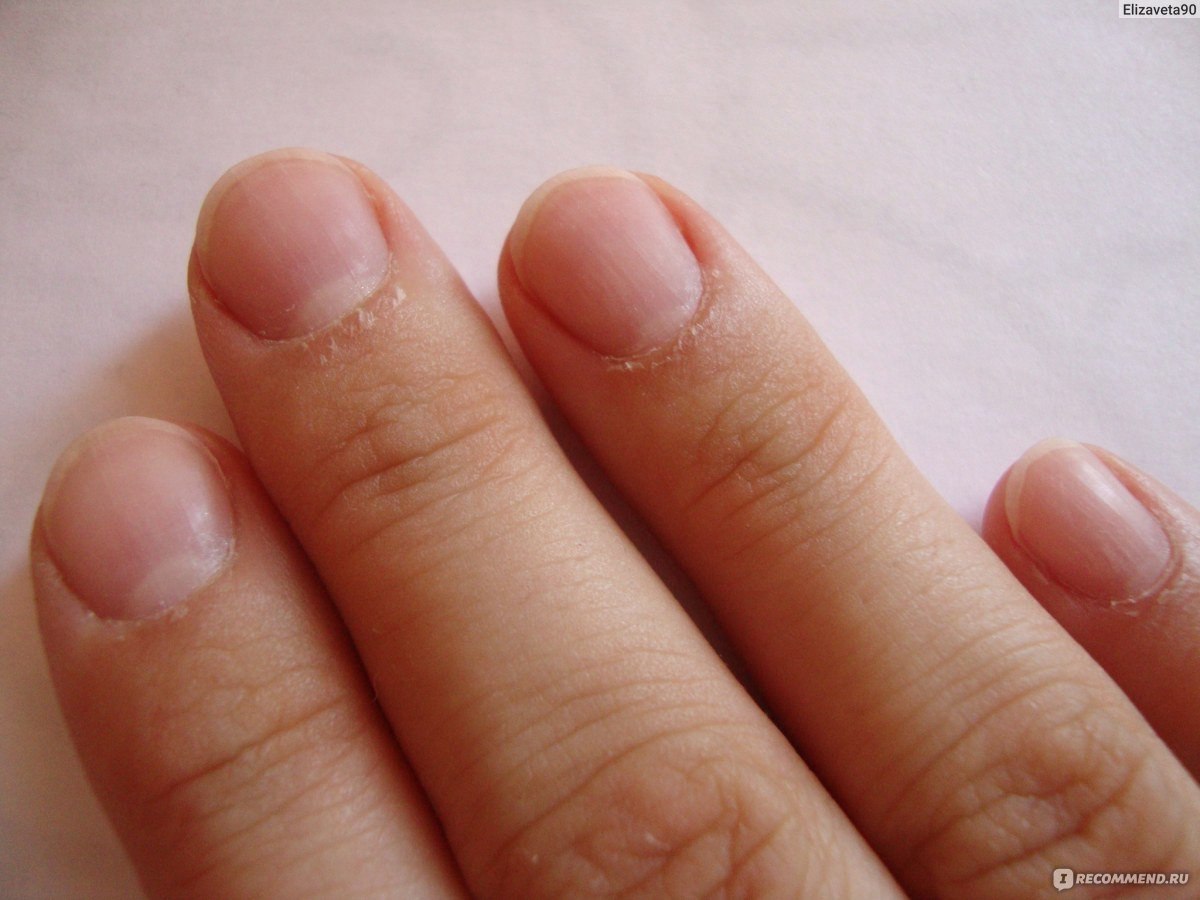 Ногти после аппаратного маникюра