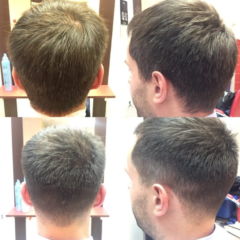Undercut сзади