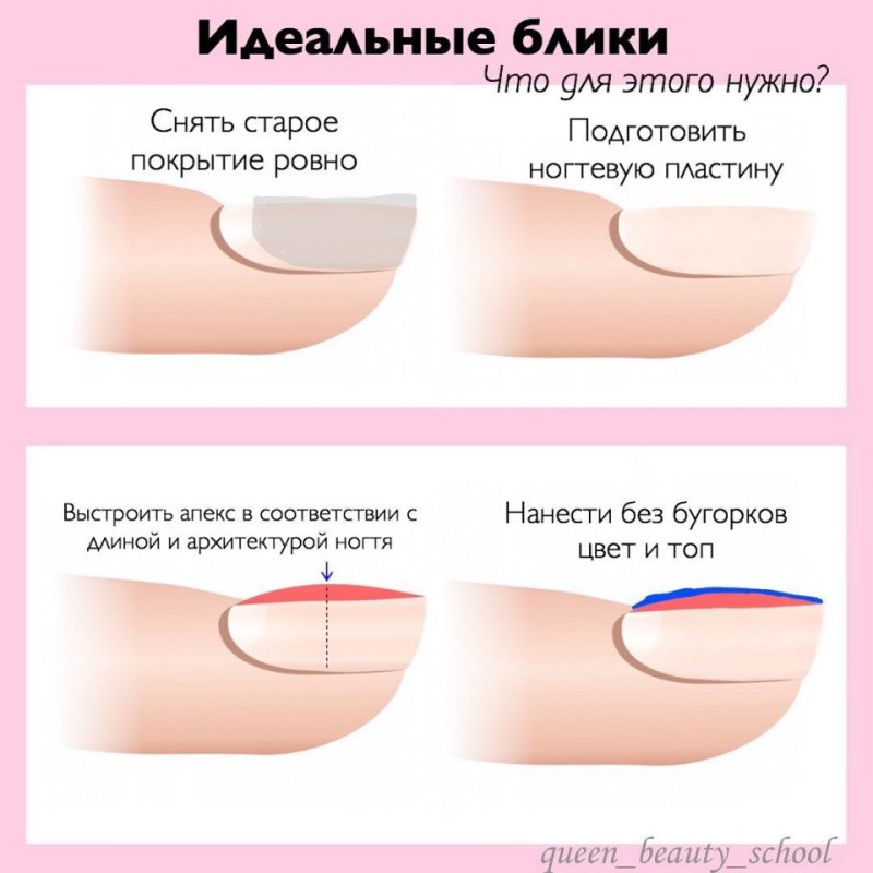 Схема выравнивания ногтевой пластины гелем