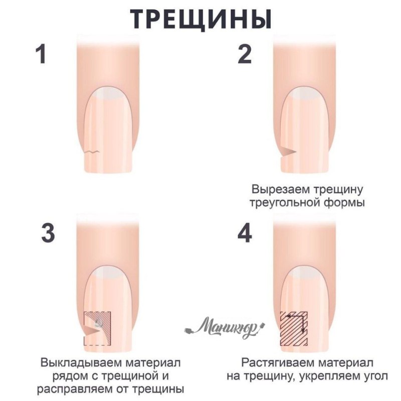 Формы и длина ногтей нарощенных
