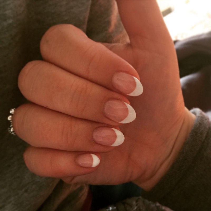 Некрасивые короткие ногти