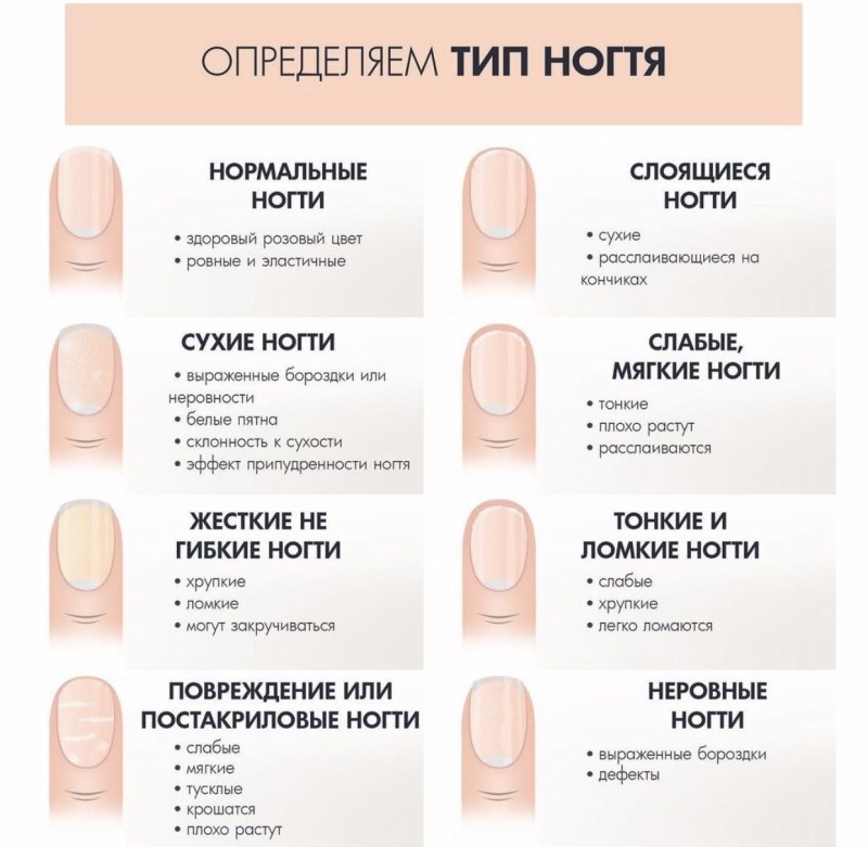 Типы ногтей нормальный ноготь