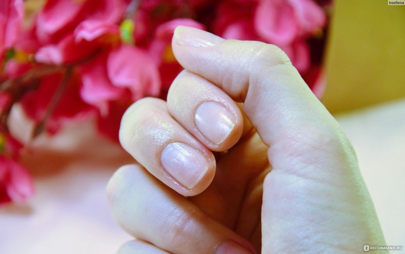 Запечатанные ногти