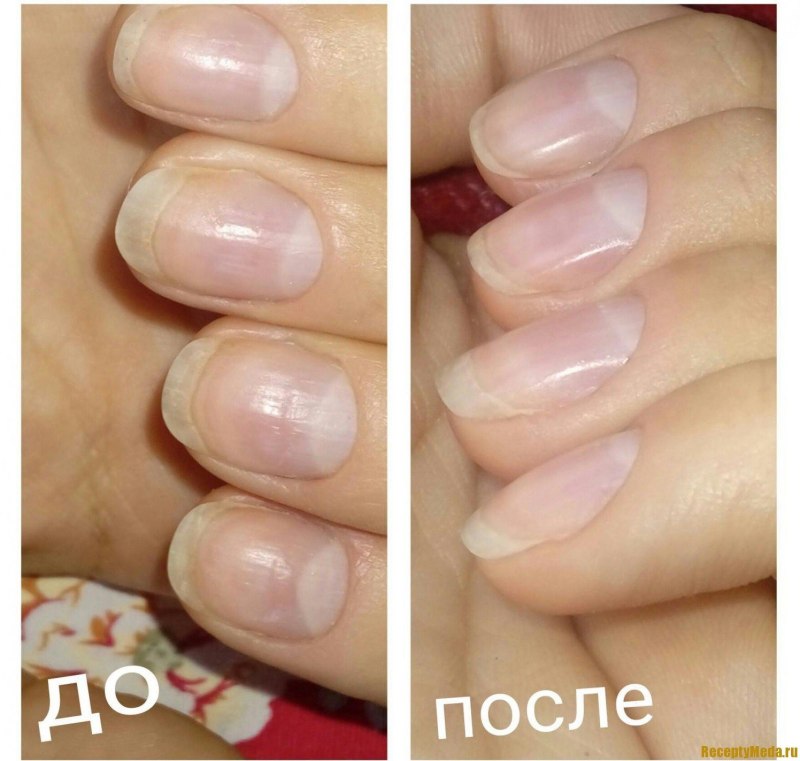 Покрытие лаком ногтей