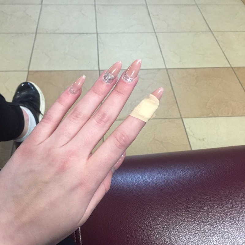 Нарощенные ногти с отслойкой