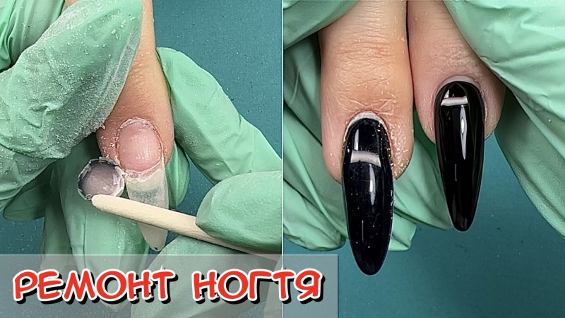Ремонт ногтя