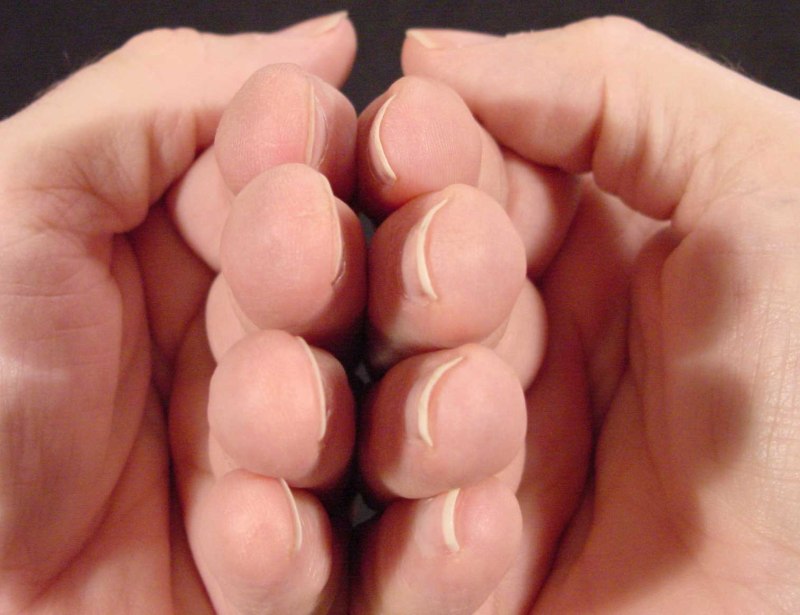 Некрасивые ногти у мужчин