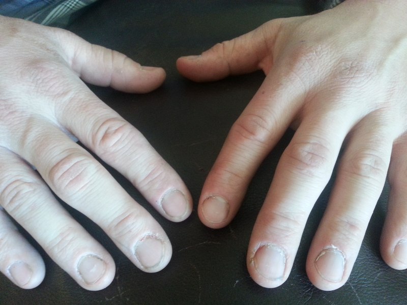 Ногти гитариста классическая гитара