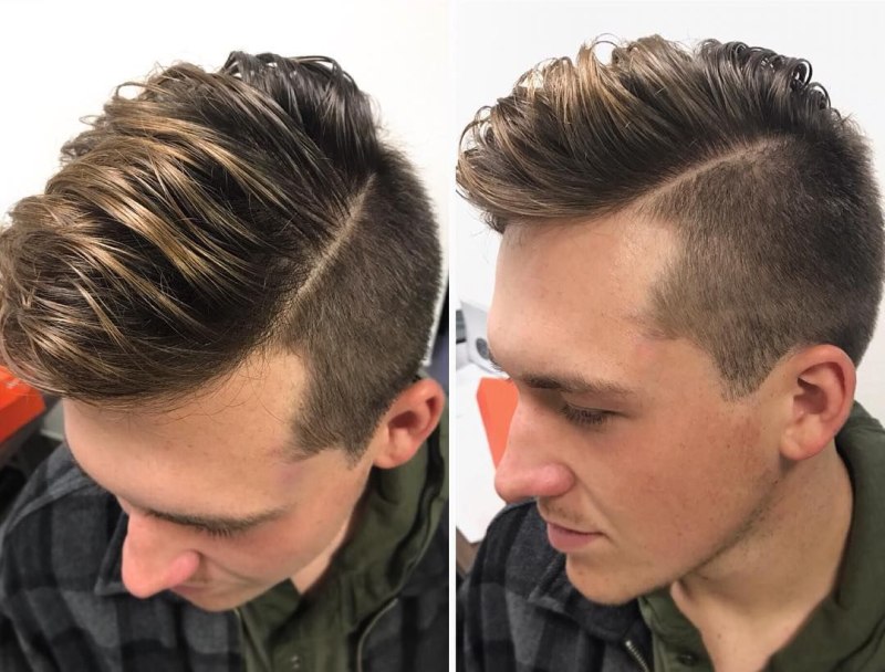 Сликбэк андеркат