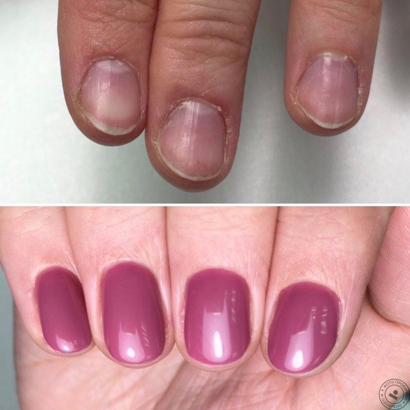 Уход за ногтями советы