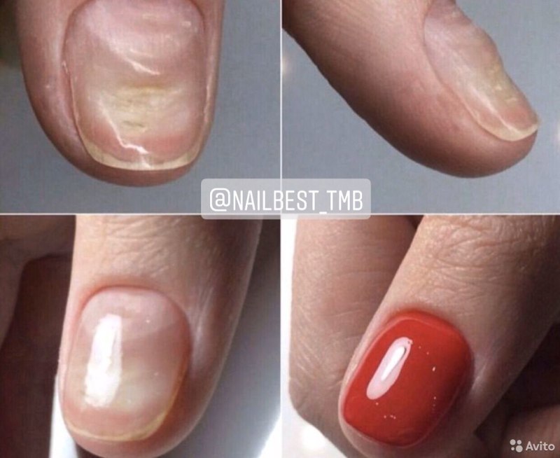 Антисептик для фрез маникюр