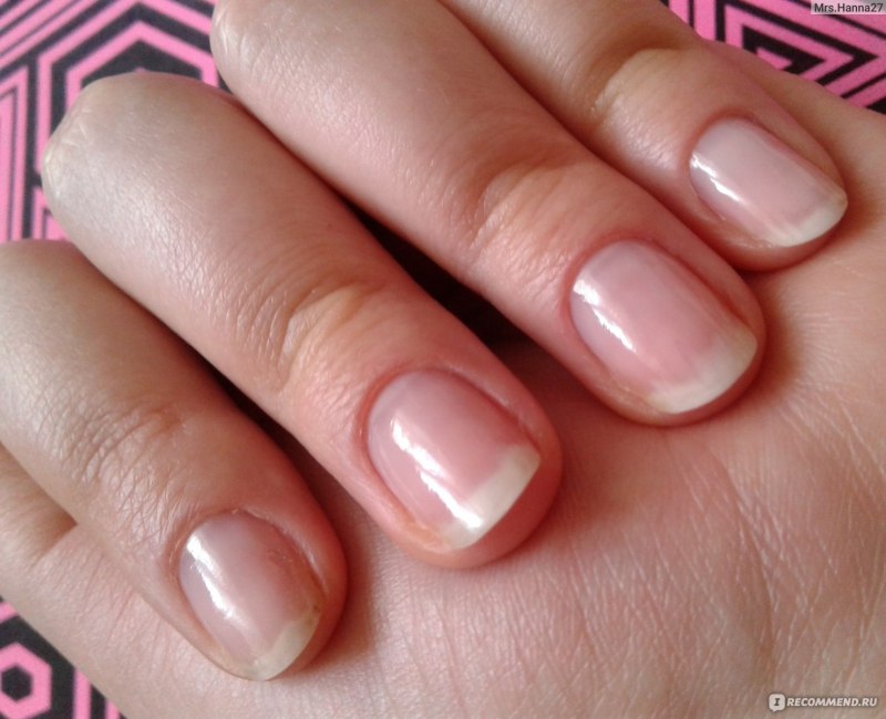 Недосушенный гель лак