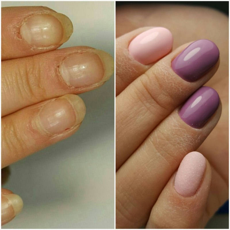 После аппаратного маникюра