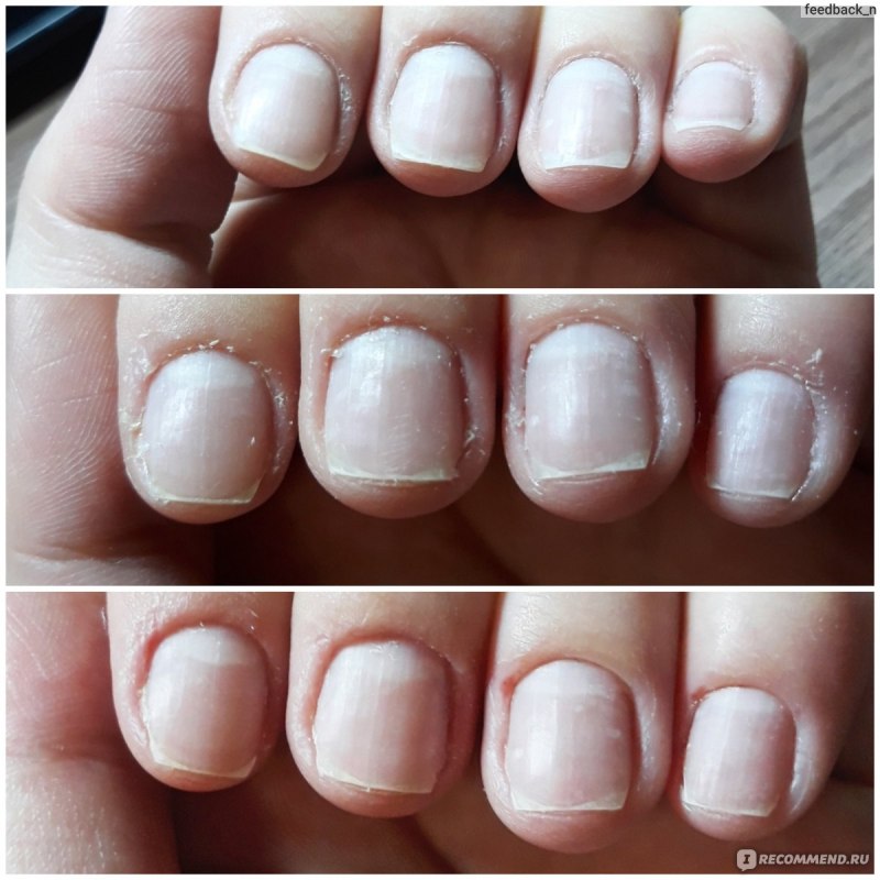 Маникюр с кутикулой