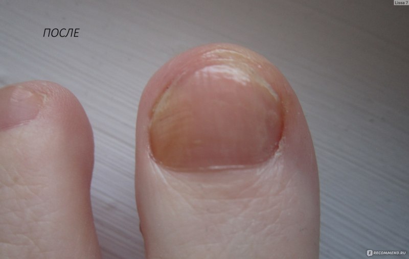 Ламинирование ногтей