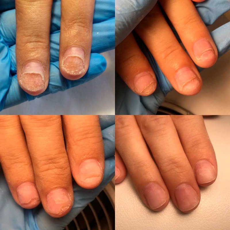 Маникюр для медиков