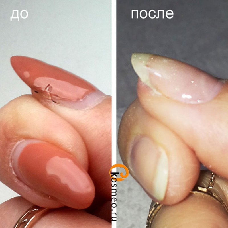 Формы ногтей