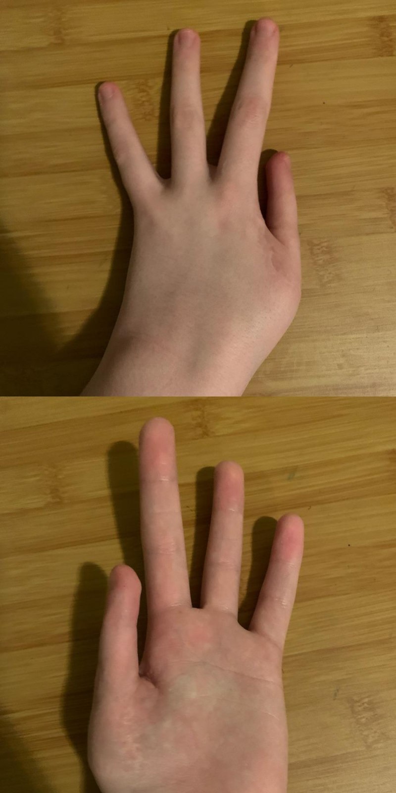 Я бегу по улице словно чумачечий