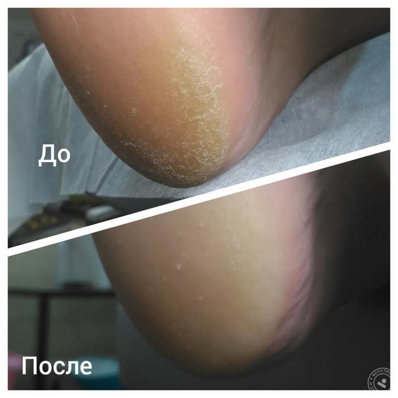 Смарт педикюр с покрытием