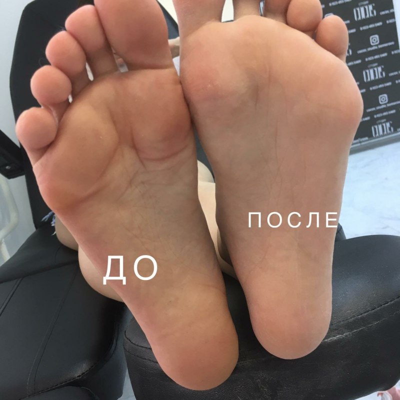 Педикюр без покрытия