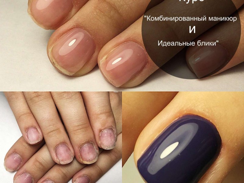 Схема выравнивания ногтевой пластины гелем