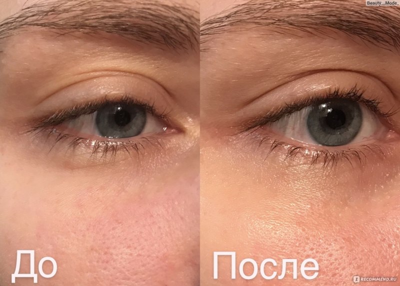 Патчи эффект до и после