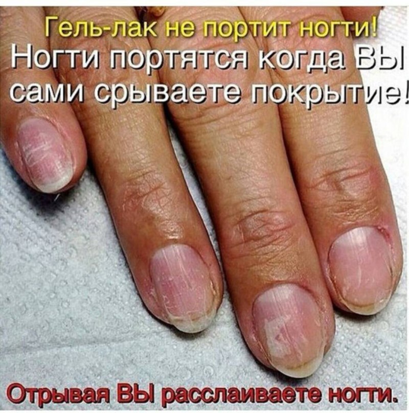 Содранное покрытие с ногтей
