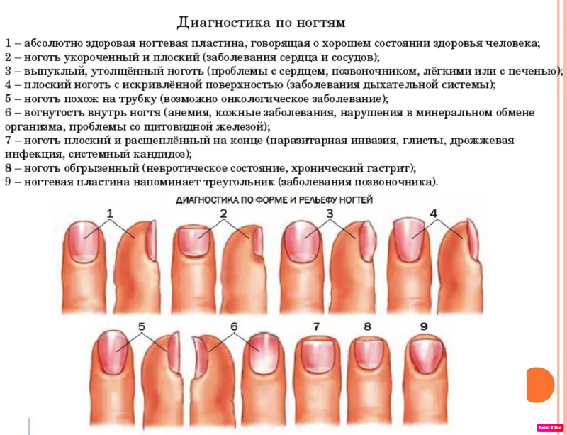 Типы поражения ногтевой пластины
