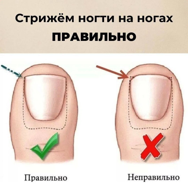 Как правильно стричь ногти