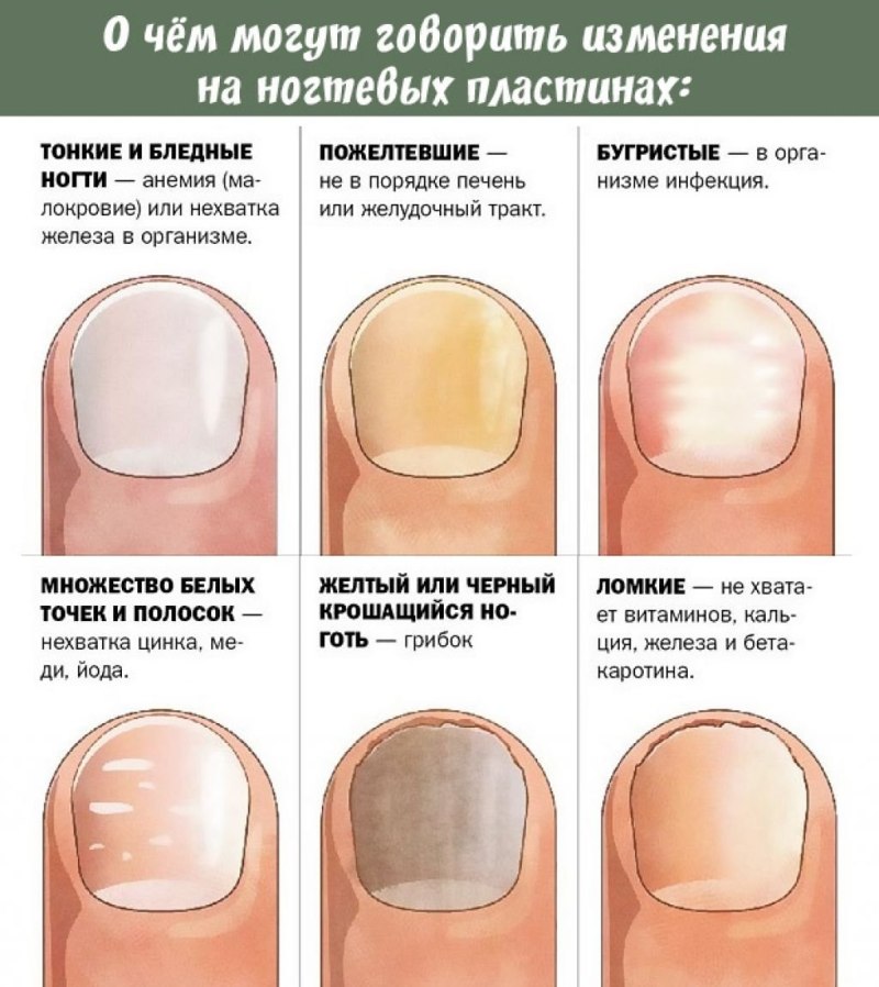 Педикюр квадратная форма