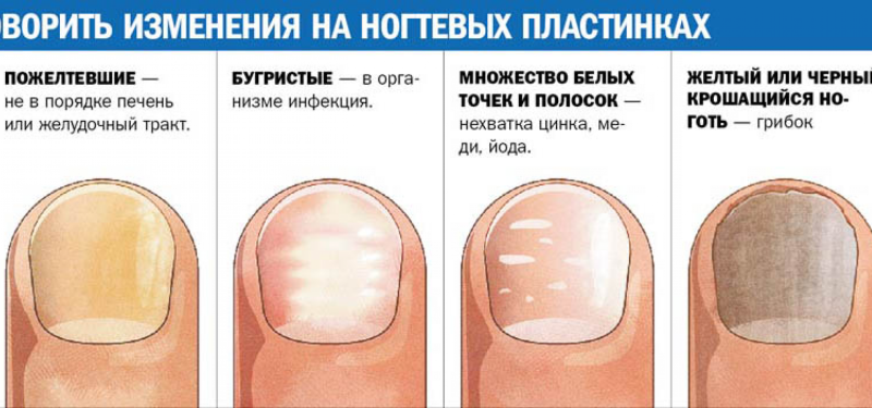 Строение ногтя на ноге большого пальца