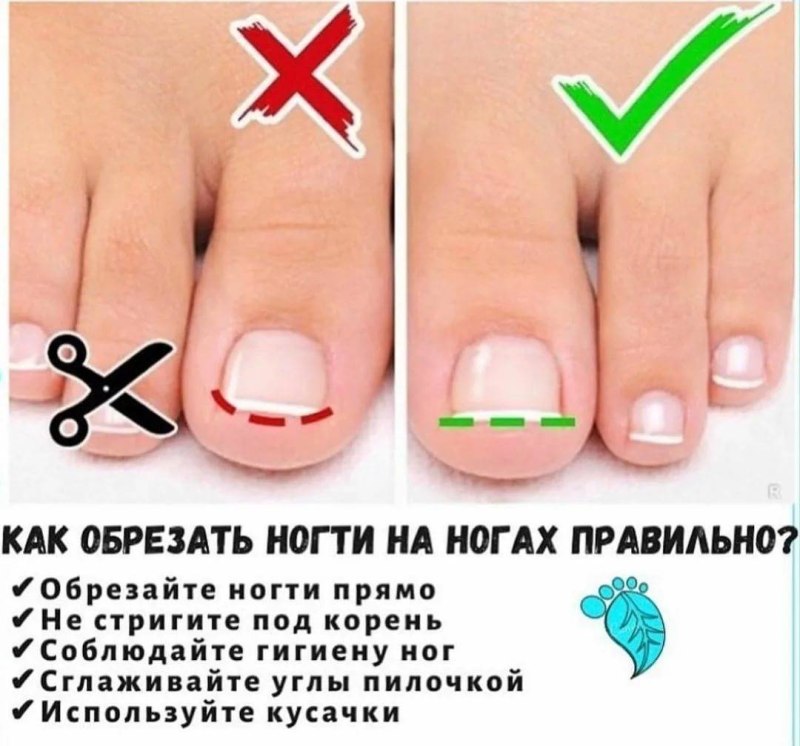 Как правильно подстригатьногтина ногвх