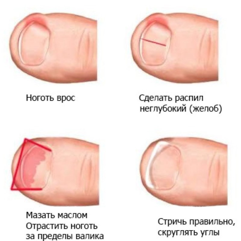 Агата Муцениеце ножки пальчики