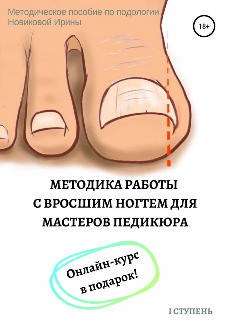 Протезирование ногтей на ногах