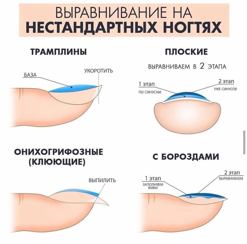 Форма ногтей вид сбоку