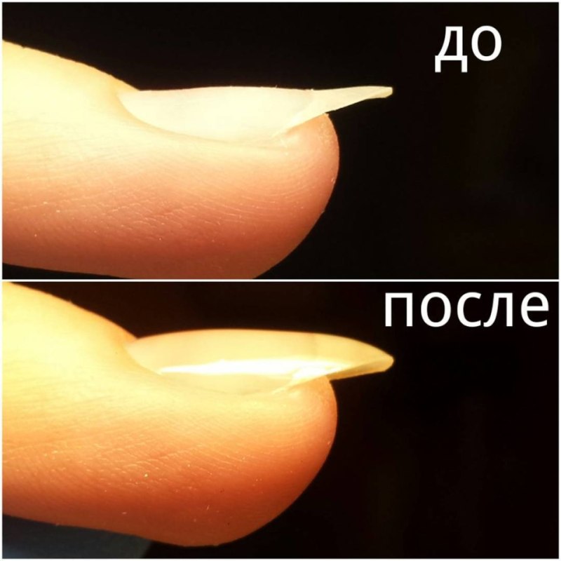 Наращивание ногтевой пластины